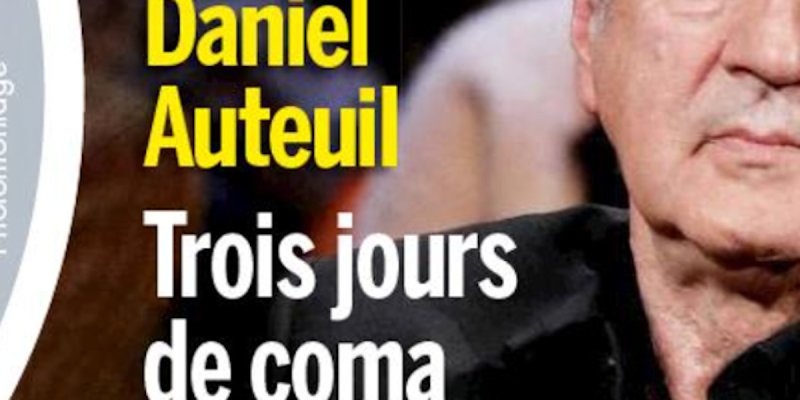 Daniel Auteuil, trois jours de coma après un accident de voiture