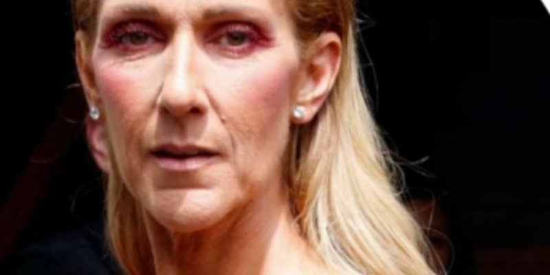 Fracture du crâne, commotion cérébrale, Céline Dion percutée de plein fouet par une voiture !