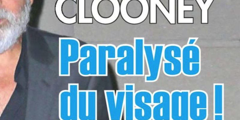 George Clooney paralysé du visage, son angoissante confidence