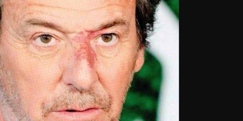 Jean-Luc Reichmann face au cancer, touché par la mort d'un enfant