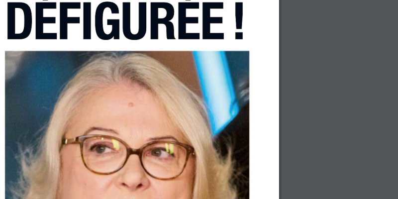 Josiane Balasko défigurée, elle n'osait plus sortir