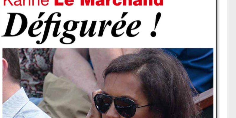 Karine Le Marchand défigurée, révélation sur sa blessure