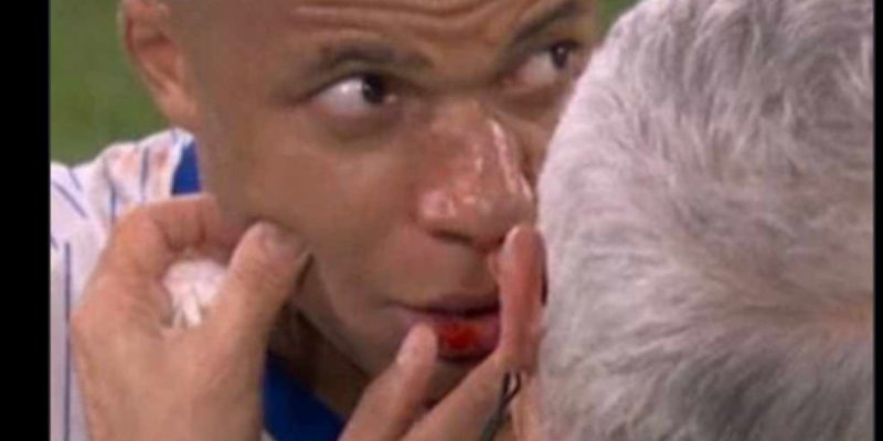Kylian Mbappé : Son nouveau look masqué après sa blessure au nez
