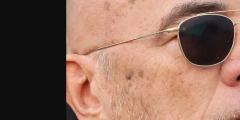 Le mystère de Pascal Obispo : Sonia Mabrouk et ses implants capillaires