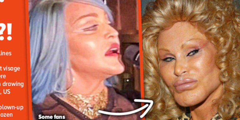 Madonna défigurée à New York, elle est comparée à Catwoman