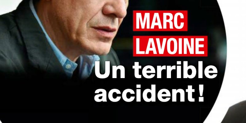 Marc Lavoine victime d'un grave accident, ses confidences