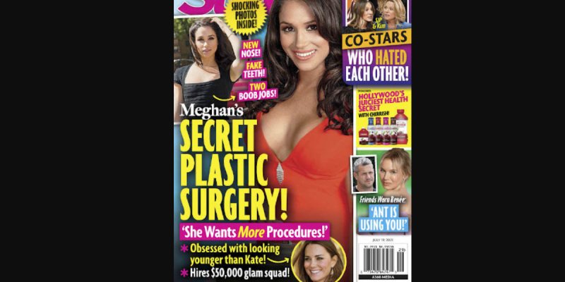 Meghan Markle et Harry, injections de comblement, Botox, leur transformation fait jaser