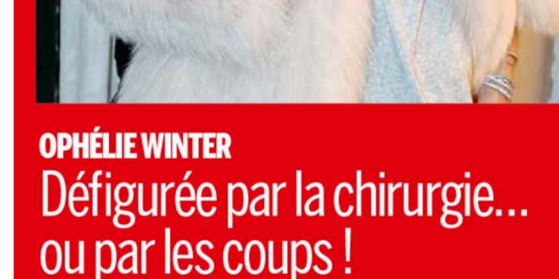 Ophélie Winter, défigurée par la chirurgie ou les coups, elle répond
