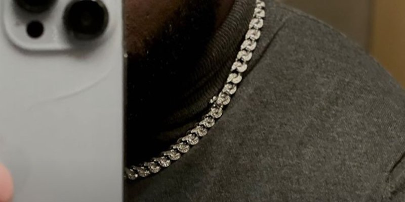 Gims, visage ensanglanté, l'artiste victime d'une violente agression