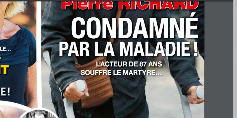 Pierre Richard face à une hyperlaxité, troubles anxieux, précisions sur ce mal sournois