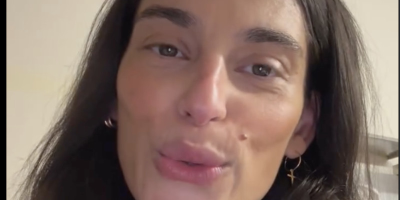 Tatiana Silva perd ses cheveux