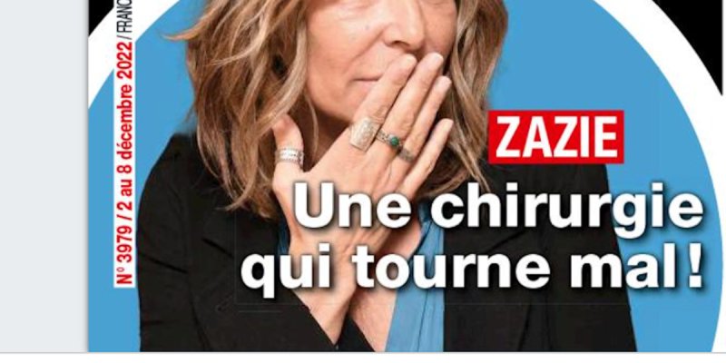 Zazie - une chirurgie qui tourne mal, immense regret (photo)