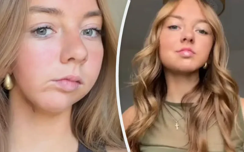 Après son cancer, Charlotte (The Voice Kids) partage le résultat de sa reconstruction de la mâchoire