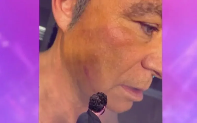 Les clichés du visage tuméfié de Fabien Lecœuvre