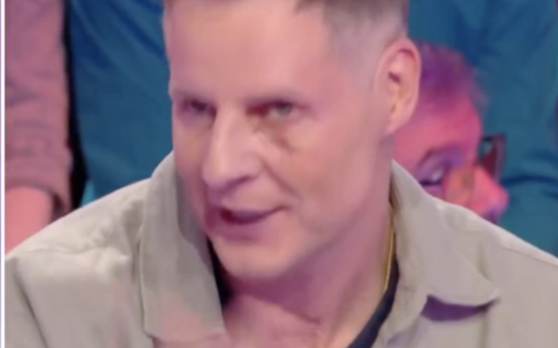 Oeil au beurre noir et hématomes : Matthieu Delormeau de retour après une chute impressionnante