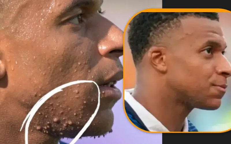 « Quelle est cette maladie ? » : Kylian Mbappé pris au piège d'une intox virale