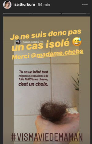 maxim-nucci-langoisse-alopecie-ce-mal-mysterieux-dont-souffre-isabelle-ithurburu