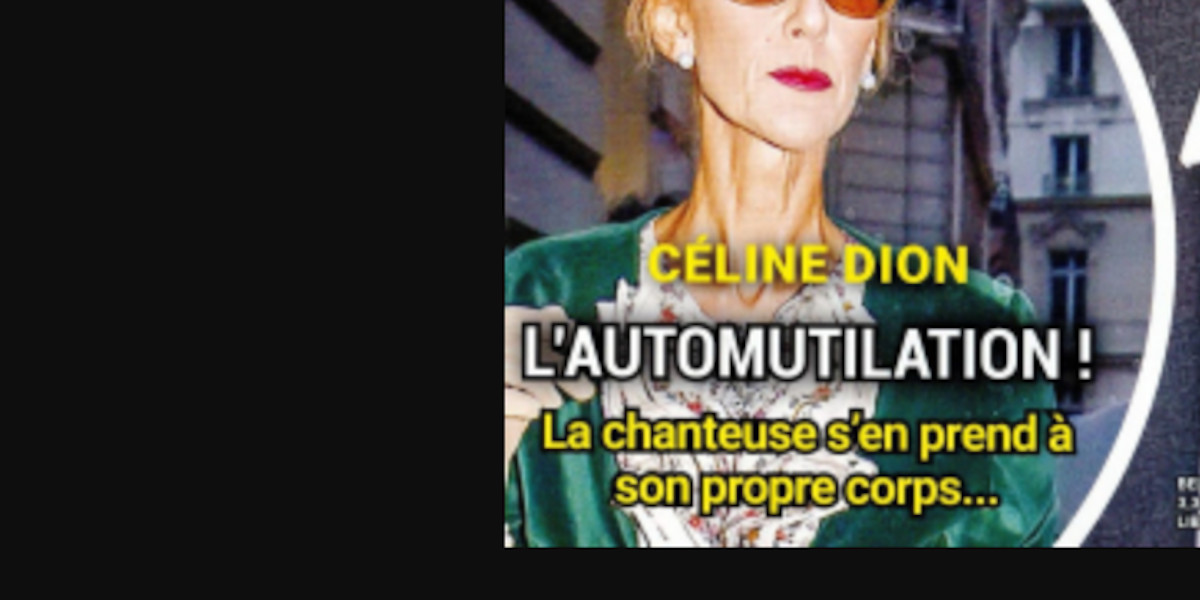 Céline Dion, l'automutilation - elle s'en prend à son propre corps, la vérité enfin (photo)