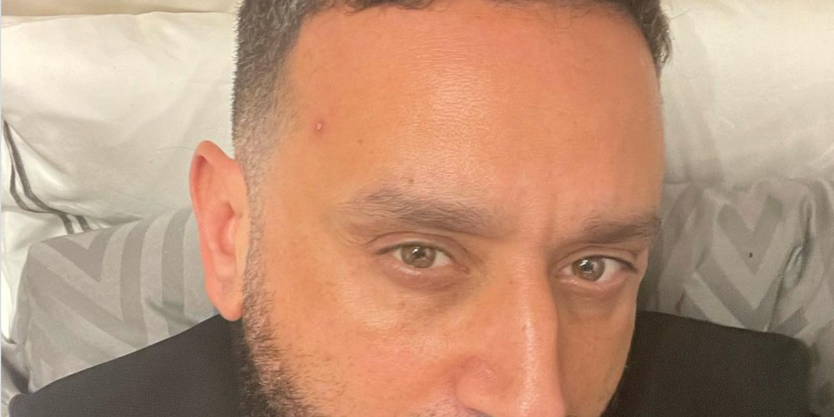 Cyril Hanouna, son visage défiguré par des boutons, Eric Zemmour lui remonte le moral