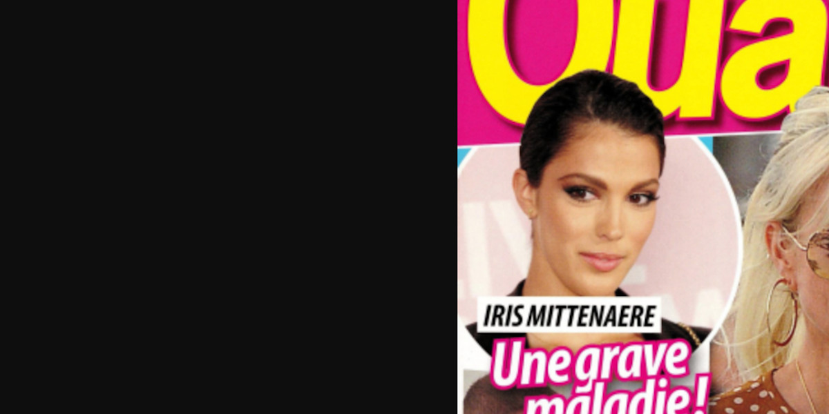 Iris Mittenaere face à une maladie neurodégénérative, le conseil précieux d'Elie Semoun
