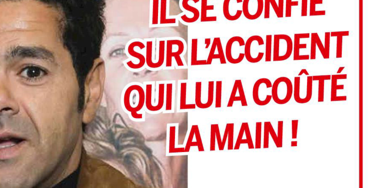 Jamel Debbouze, émouvantes confidences sur l'accident qui lui a coûté la main
