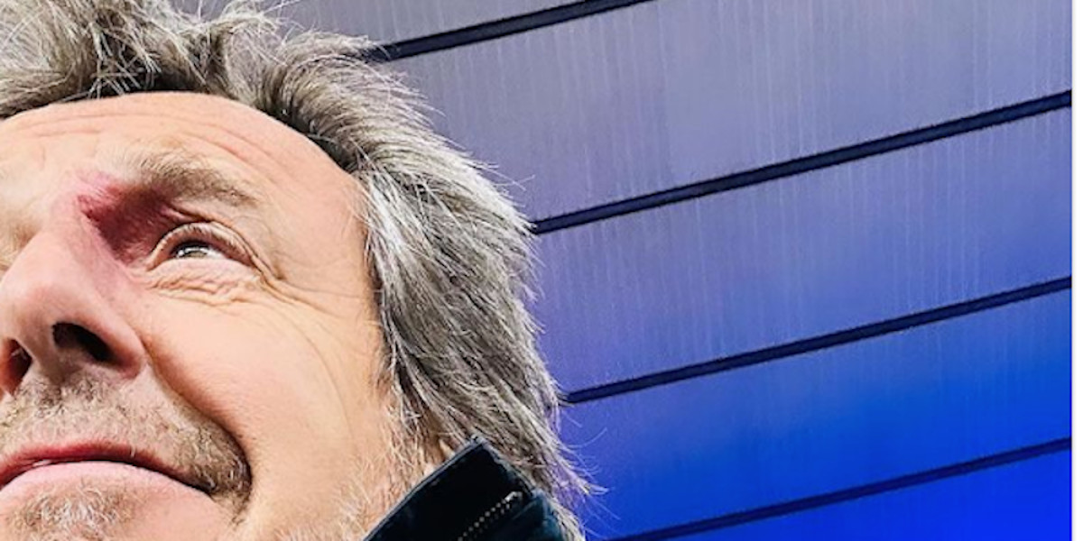 Jean-Luc Reichmann déclaré mort sur la route !