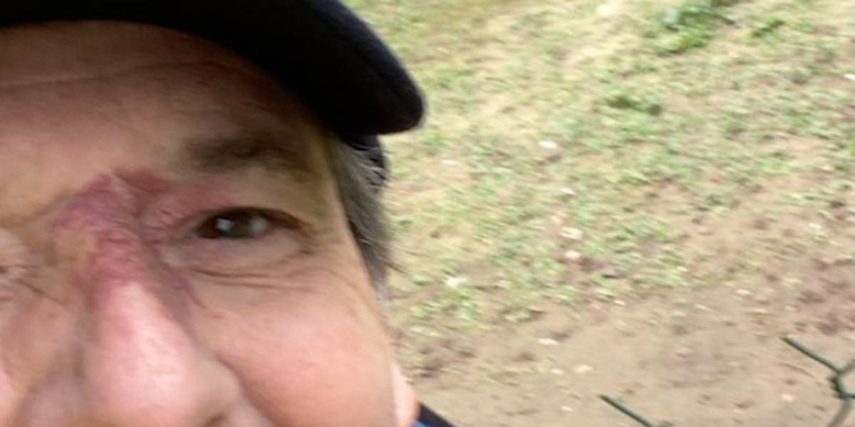 Jean-Luc Reichmann fin de cauchemar, fin d'enfer, il rassure sur son état (vidéo)