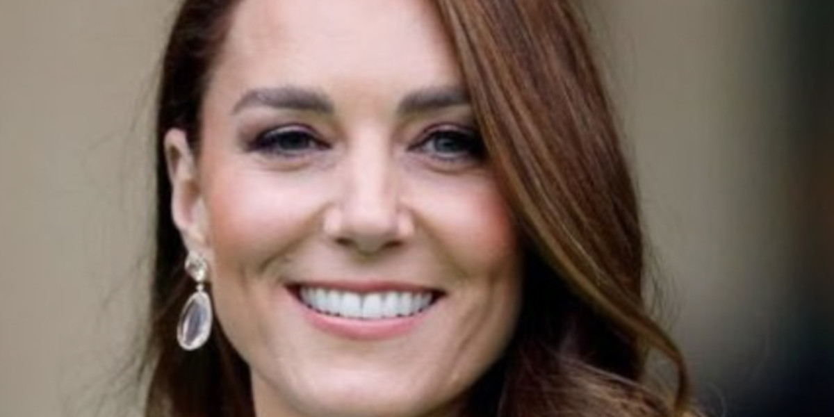 Kate Middleton, une autre intervention gardée secrète : la cicatrice sur sa tête