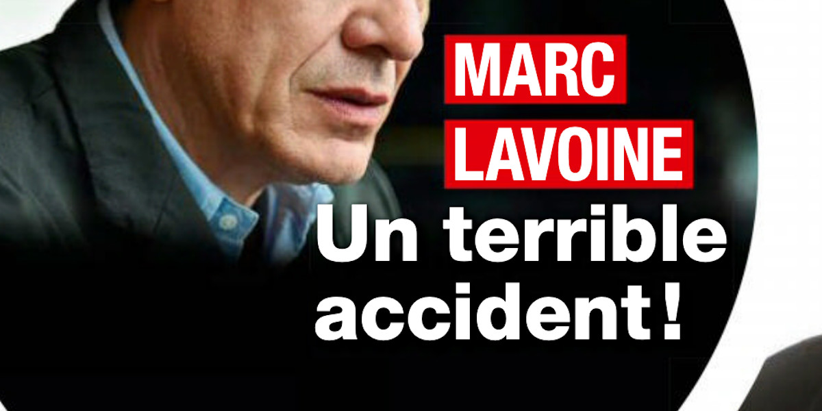 Marc Lavoine victime d'un grave accident, ses confidences