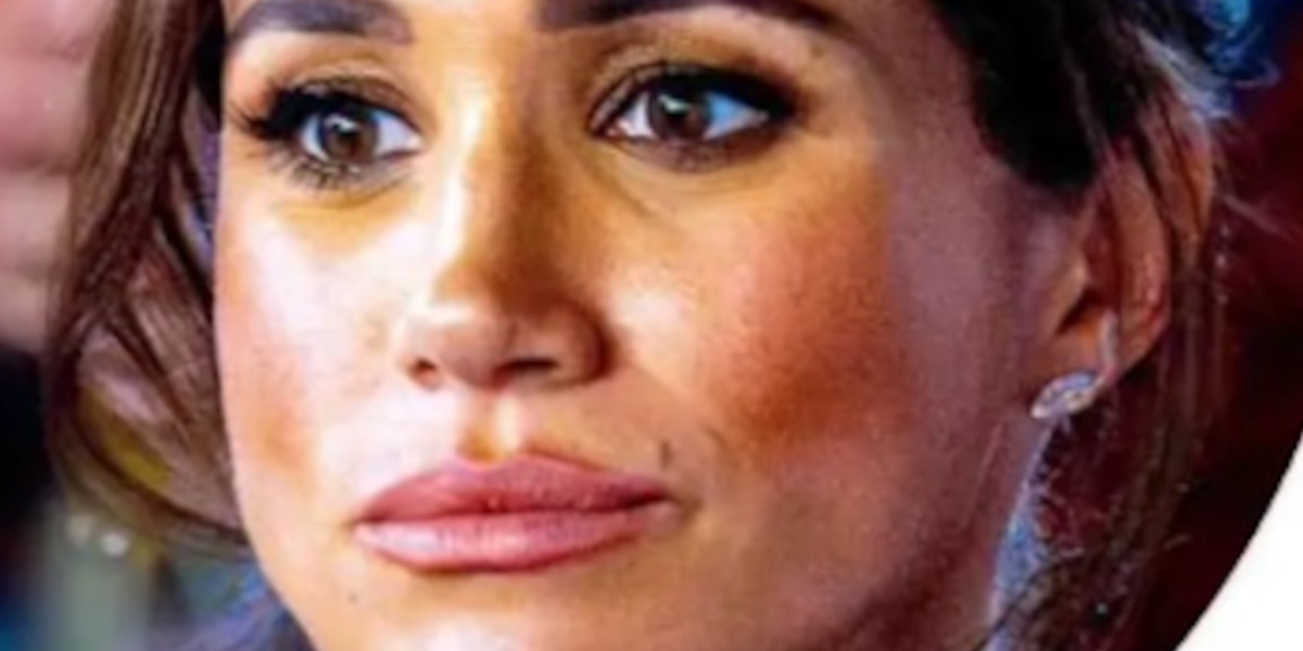 Meghan Markle, de graves problèmes de santé 