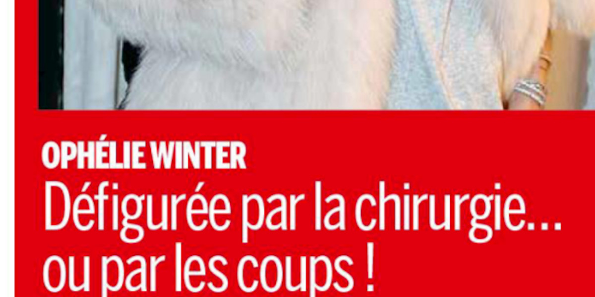 Ophélie Winter, défigurée par la chirurgie ou les coups, elle répond