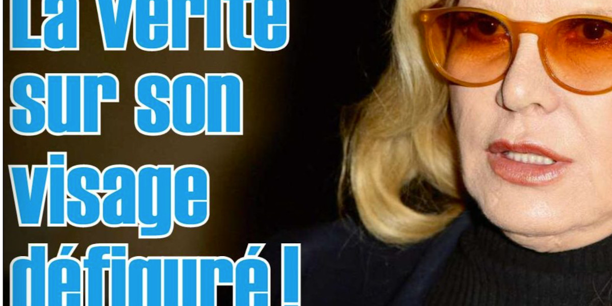 Sylvie Vartan, la vérité sur son visage défiguré