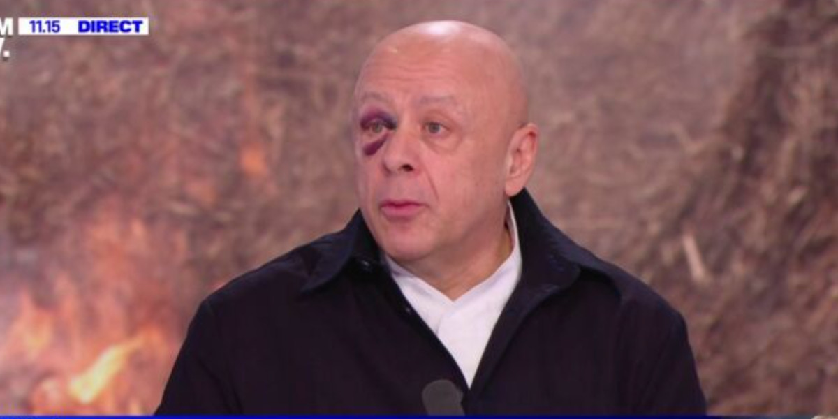 Thierry Marx dévoile un coquard mystérieux en direct sur BFM TV, la raison révélée 