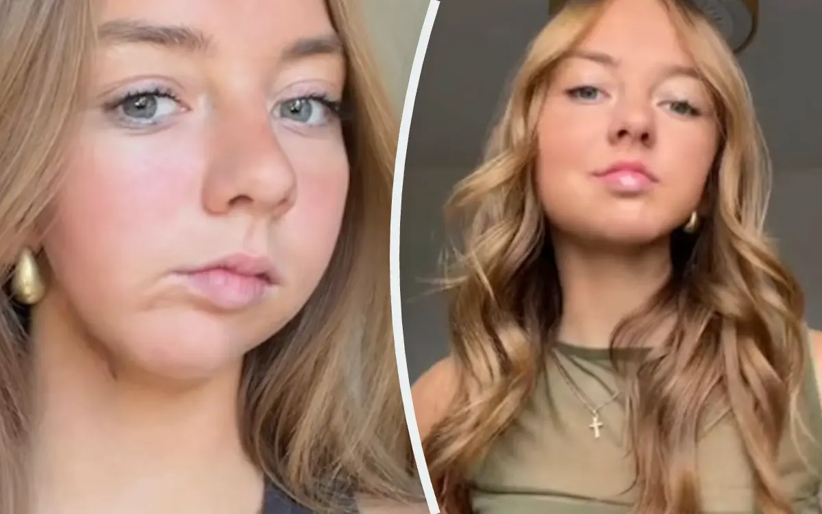 Après son cancer, Charlotte (The Voice Kids) partage le résultat de sa reconstruction de la mâchoire