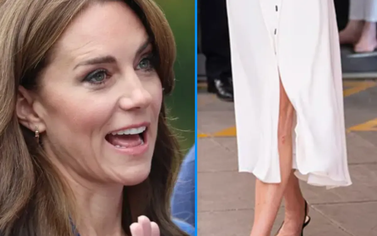 Kate Middleton : la petite blessure à la jambe qui intrigue lors d'une sortie officielle