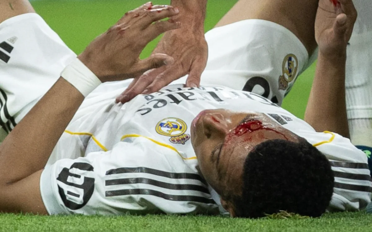 Kylian Mbappé en sang : l'image effroyable qui a terrifié Ester Expósito en plein match !