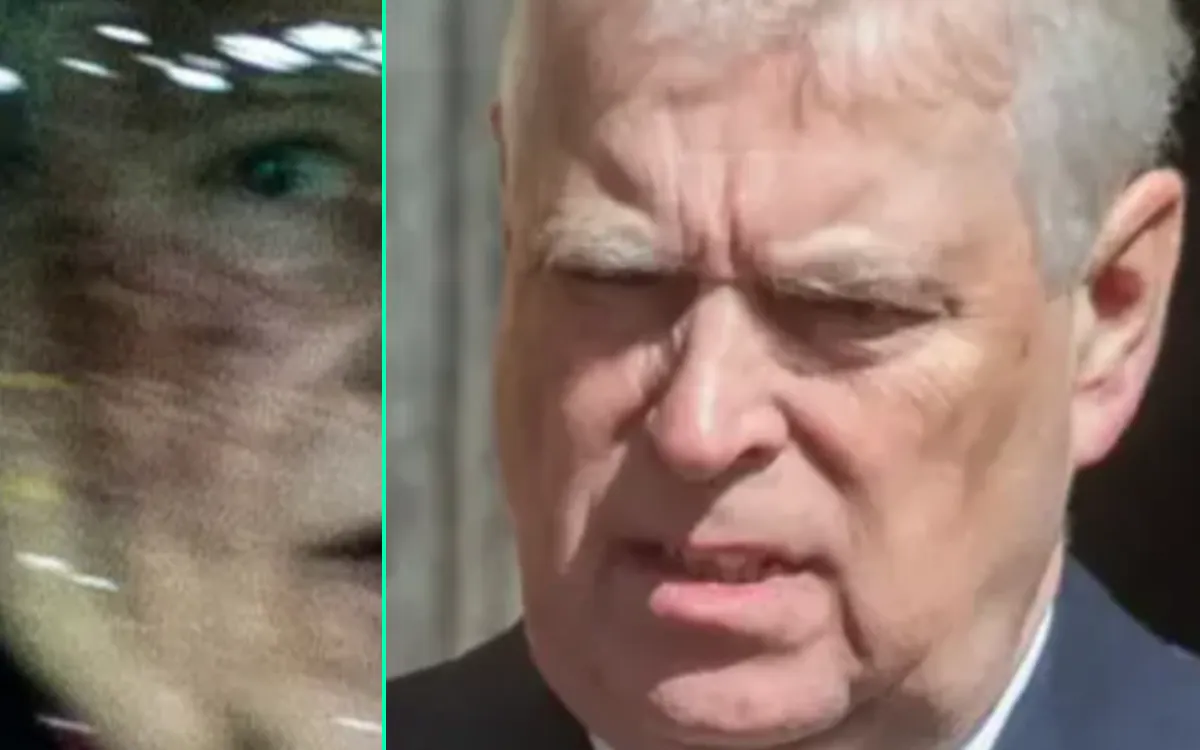Mystérieuse blessure pour le prince Andrew, énorme hématome au visage
