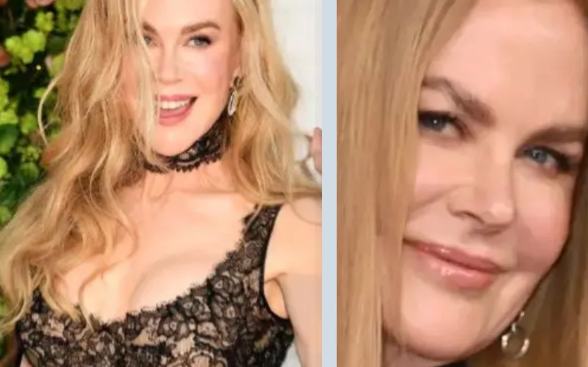 Nicole Kidman : son décolleté relance les rumeurs, un chirurgien évoque une augmentation mammaire