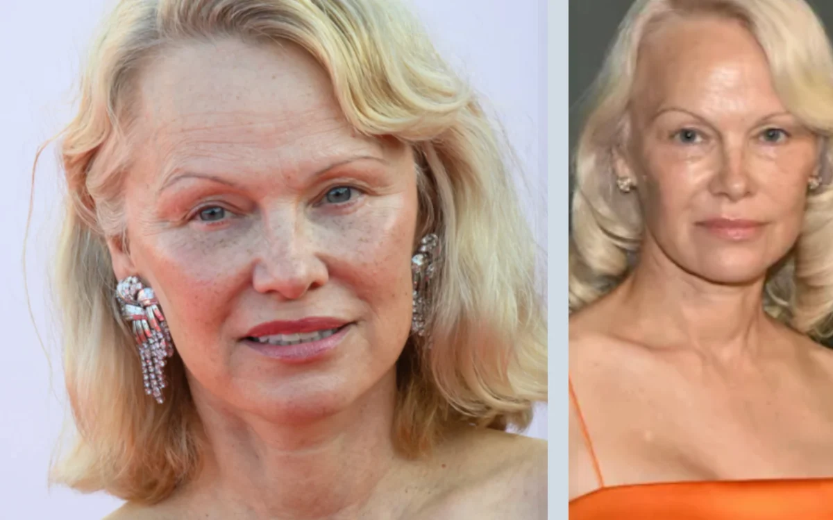 Pamela Anderson : son traitement à 100 000 dollars refait surface, mais son récit a changé