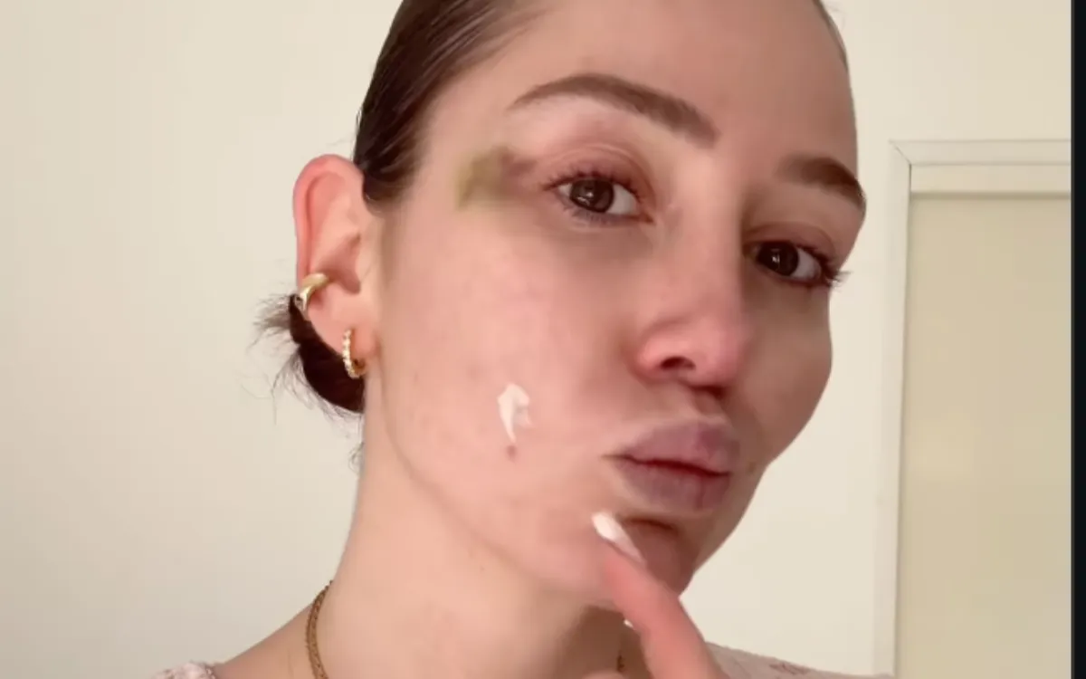 « Une chute accidentelle » : Éloïse Appelle s'explique sur son bleu au visage