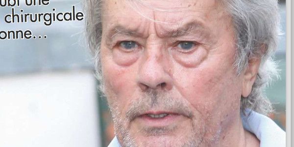 Alain Delon fragilisé mentalement après son opération secrète