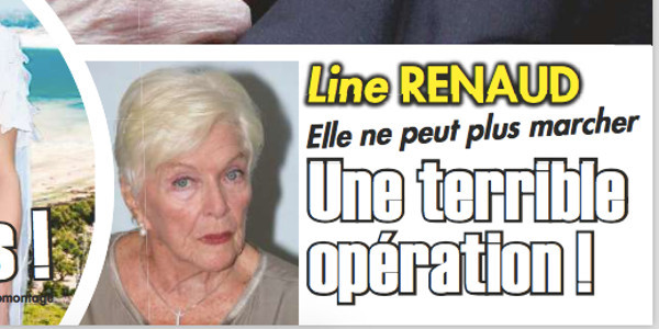 Line Renaud, une terrible opération, elle brise le silence