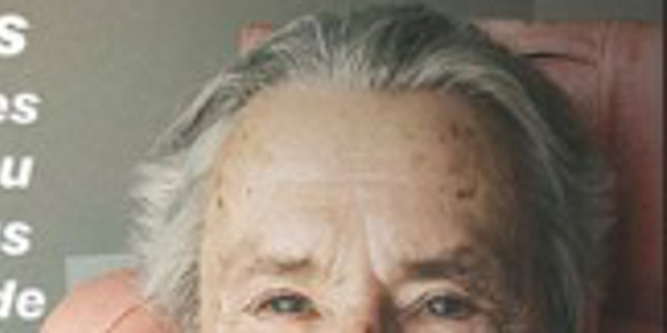 Alain Delon inquiète, soins orthopédiques, très amaigri, la vérité sur son état