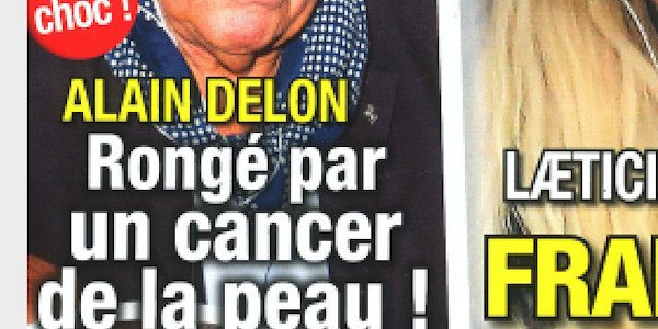 Alain Delon, le choc, "rongé" par le cancer de la peau (photo)
