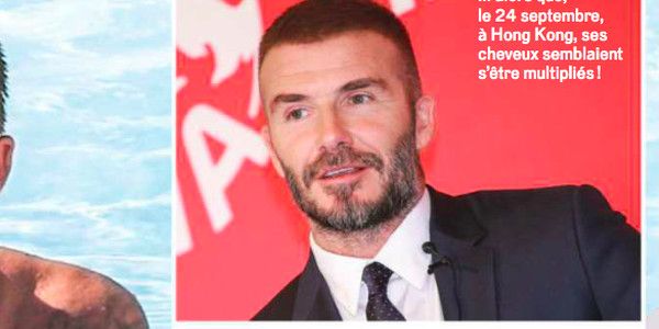 David Beckham s'est fait des implants capillaires (photo)