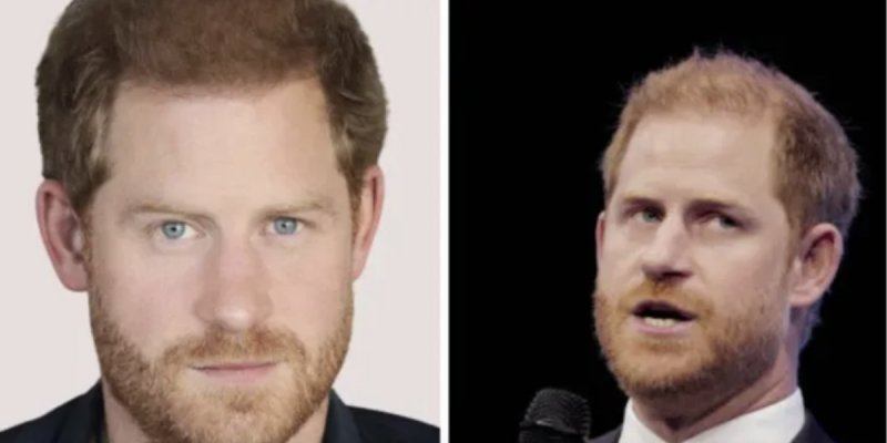 Prince Harry et la calvitie : sa blague aux WellChild Awards