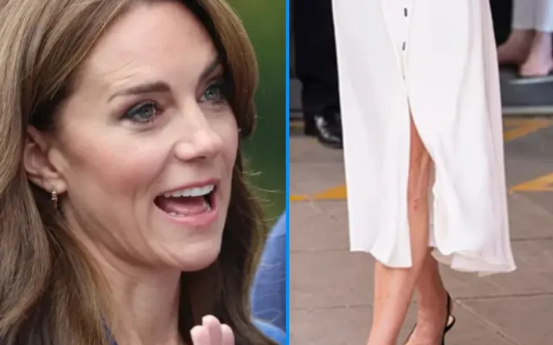 Kate Middleton : la petite blessure à la jambe qui intrigue lors d'une sortie officielle