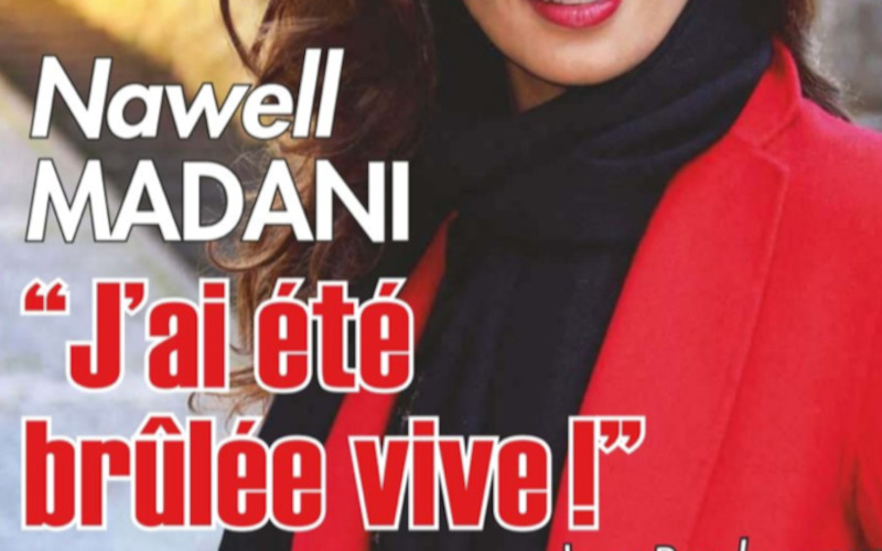 Nawell Madani, le choc, "J'ai été brûlée vive"
